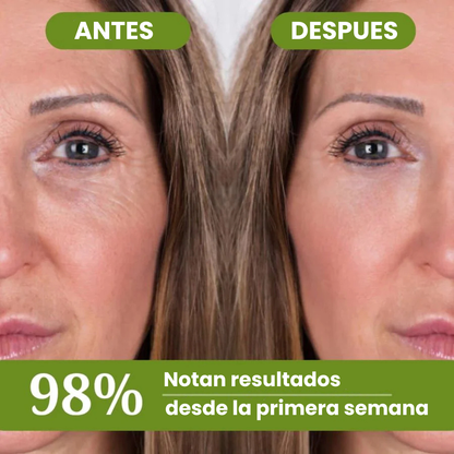 Retinal G-Max™ Triple Acción